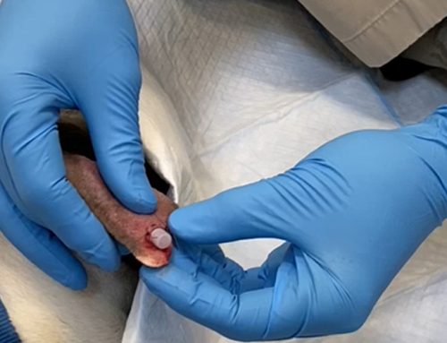 Ear-Hematoma